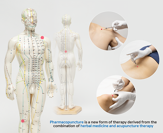 Pharmacopuncture therapy